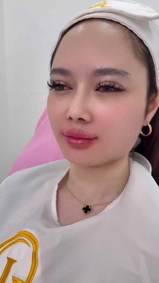 TikTok video thumbnail by purraclinic