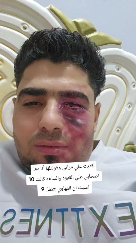TikTok video thumbnail by modrenar