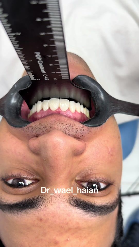 TikTok video thumbnail by waelhayan
