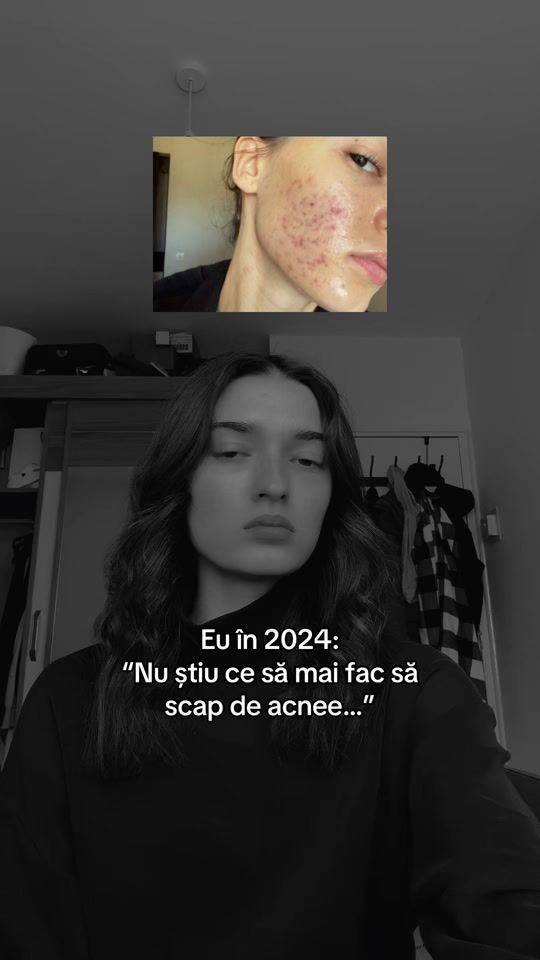 TikTok video thumbnail by alyy.nna