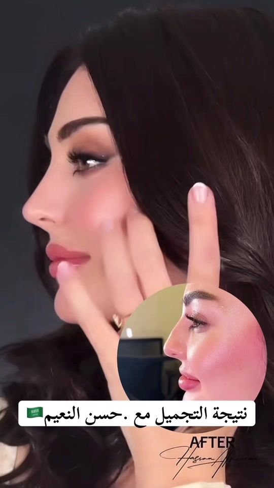 TikTok video thumbnail by xsh9999