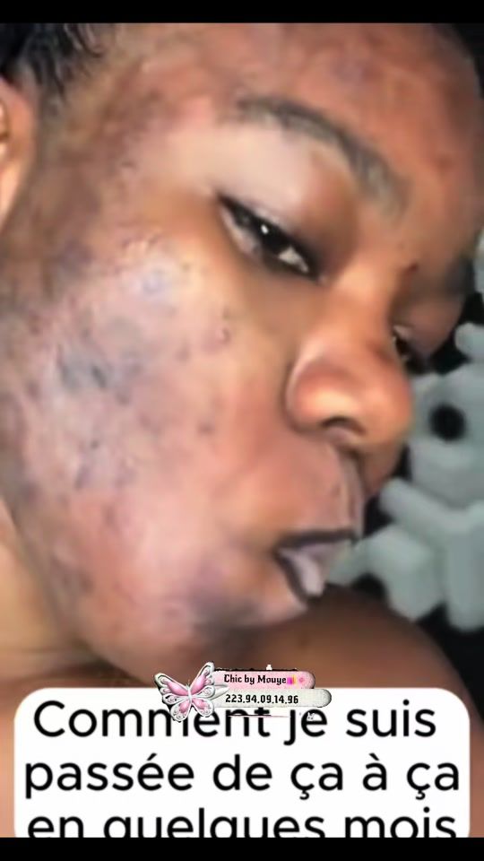 TikTok video thumbnail by chez_mouye