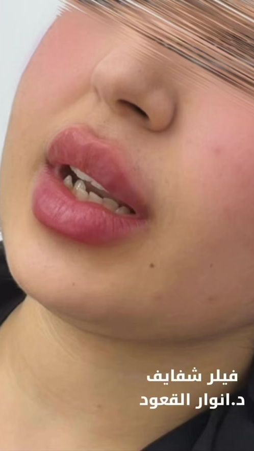 TikTok video thumbnail by beauties91dr