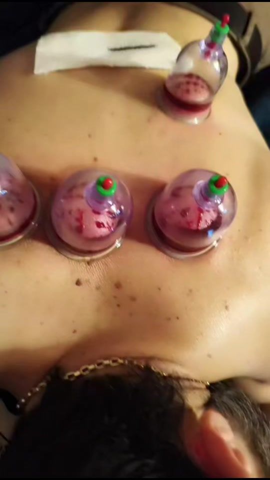 TikTok video thumbnail by tibb_bacisi_03_