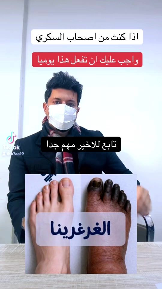 TikTok video thumbnail by a7aa19