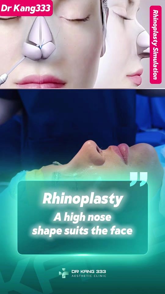 TikTok video thumbnail by dr.kang333