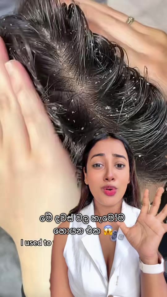 TikTok video thumbnail by amawijayasinghe