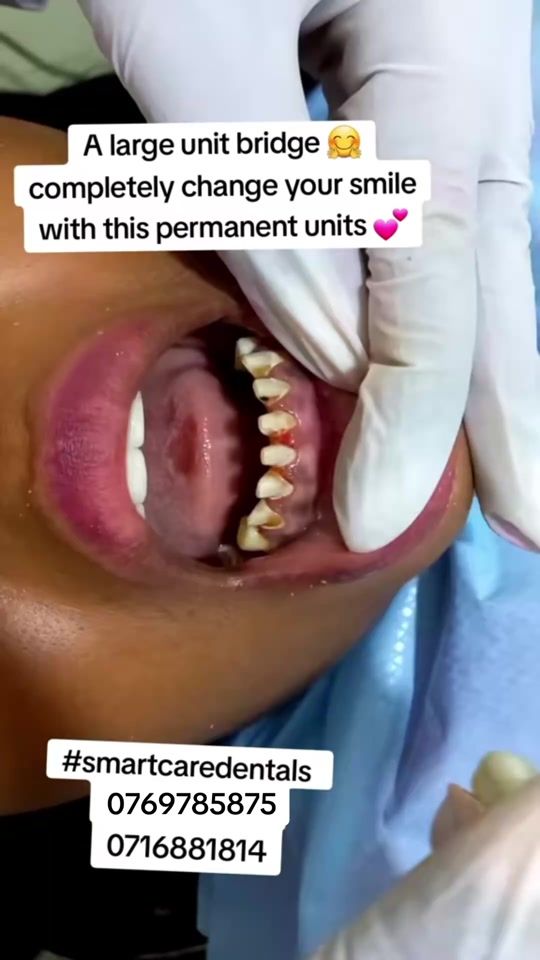 TikTok video thumbnail by smartcaredentalsnairobi