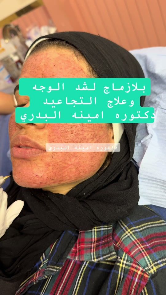 TikTok video thumbnail by dr.amina.albadry