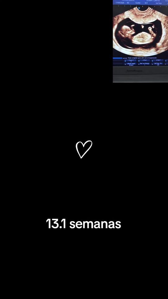 TikTok video thumbnail by drahernandezgio