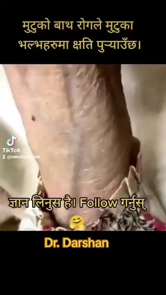 TikTok video thumbnail by merodoctorsaab