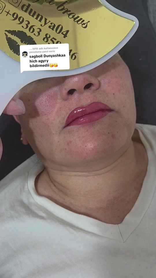 TikTok video thumbnail by dunka04