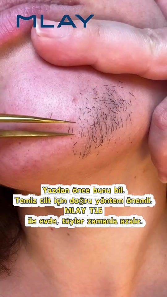 TikTok video thumbnail by mlay_turkiye