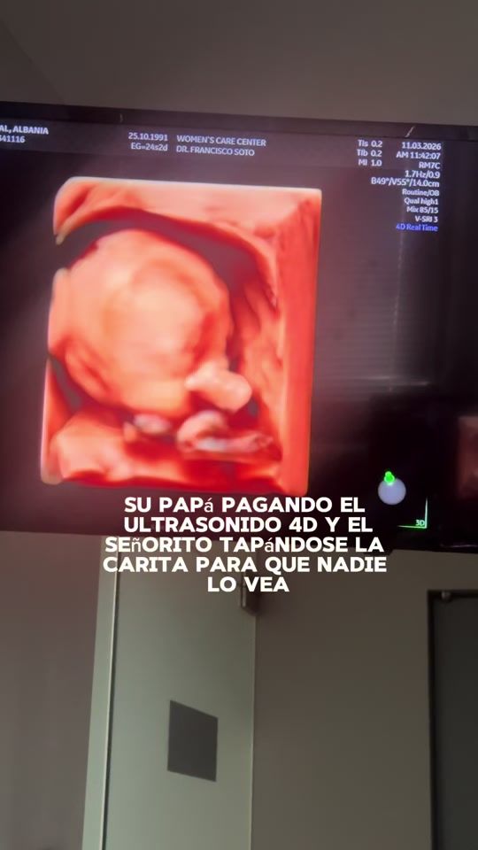 TikTok video thumbnail by albaniaespinal3