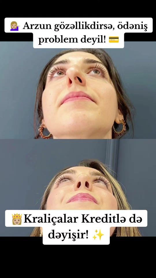TikTok video thumbnail by dr.lorcerrah