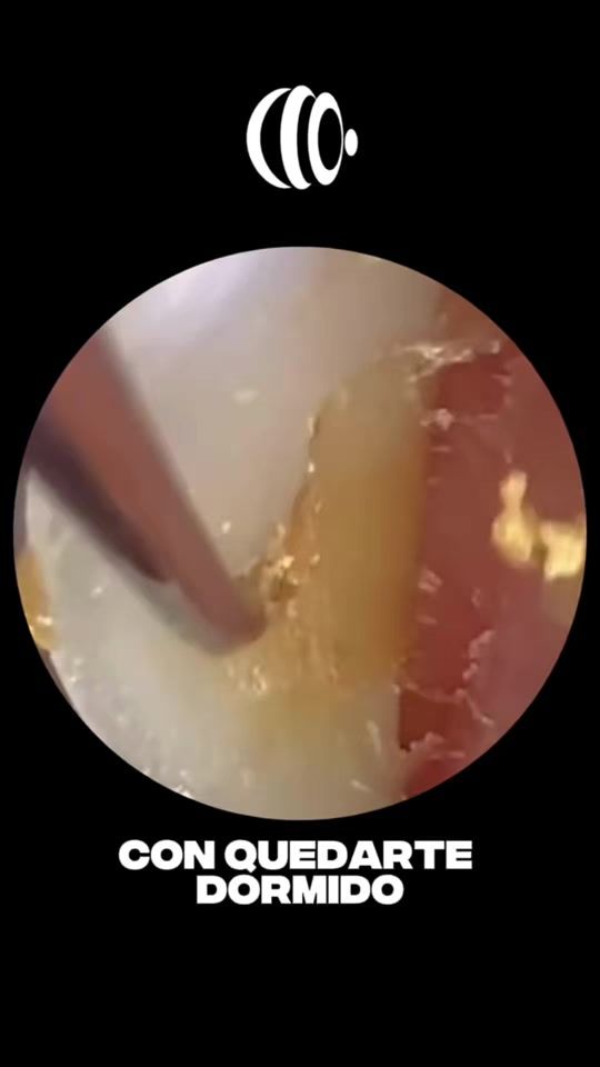 TikTok video thumbnail by drateresita