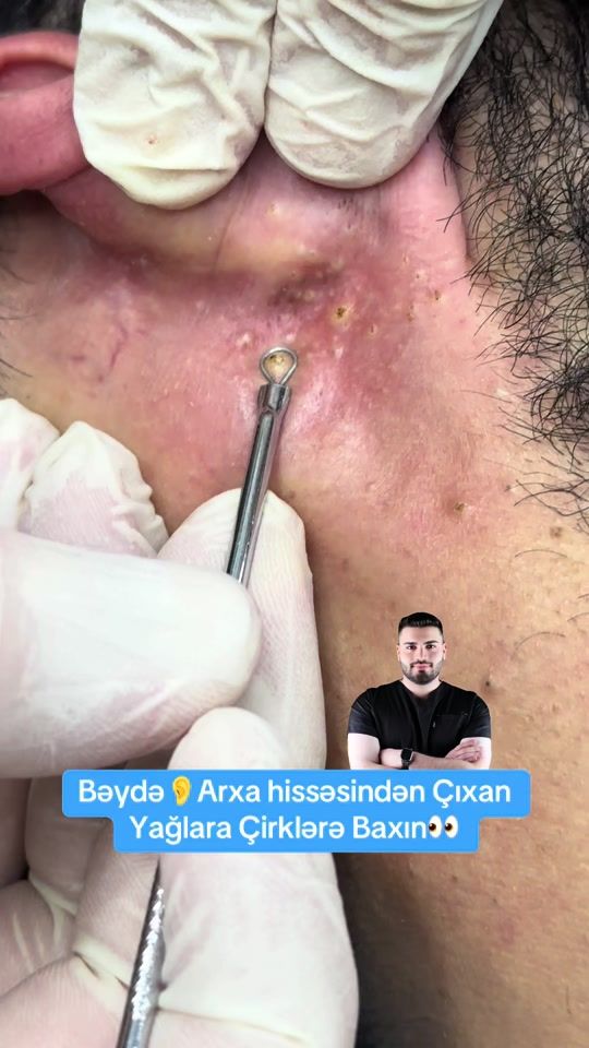 TikTok video thumbnail by dr.nicathuseyn