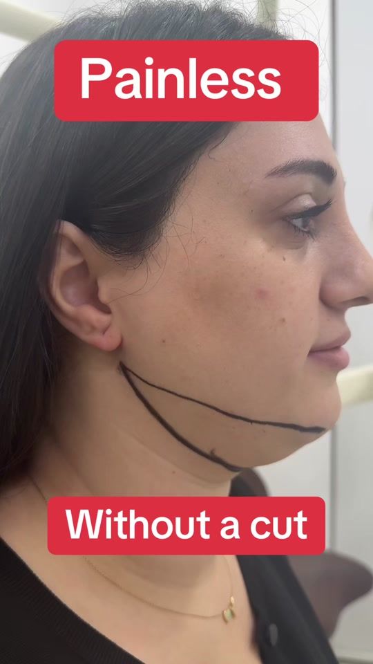 TikTok video thumbnail by dr.ibrahimbeyli