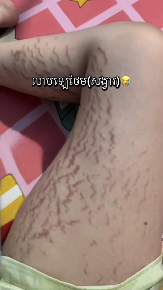 TikTok video thumbnail by eee_linn168