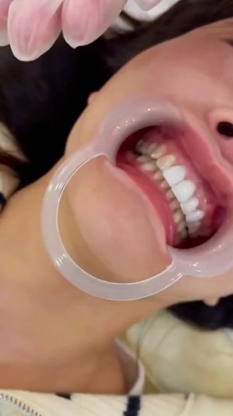 TikTok video thumbnail by dr.metrey99