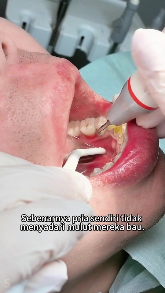 TikTok video thumbnail by beautyhabittid