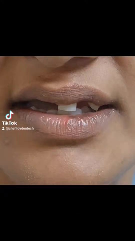 TikTok video thumbnail by cheflloydentech