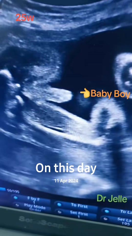 TikTok video thumbnail by drmojele