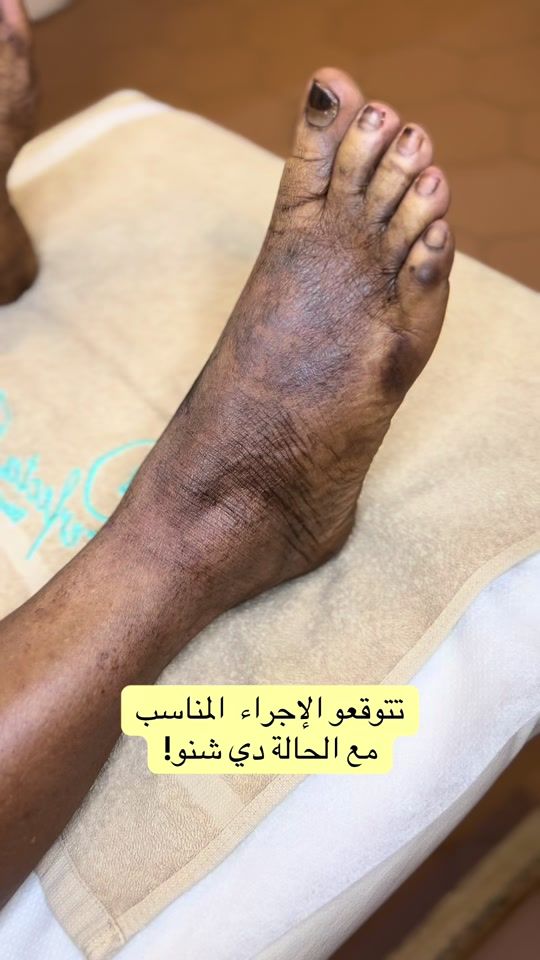 TikTok video thumbnail by perfecta_clinic_