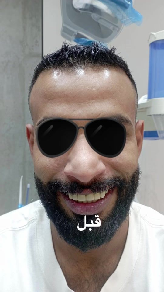 TikTok video thumbnail by waelhayan
