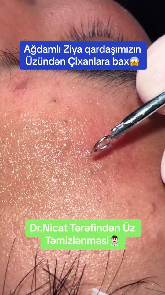 TikTok video thumbnail by dr.nicathuseyn