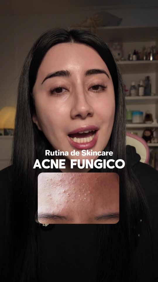 TikTok video thumbnail by scamlizx