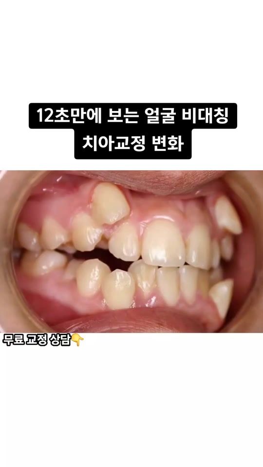TikTok video thumbnail by misodream_dr