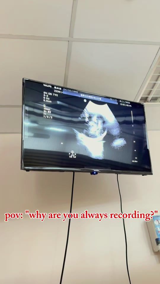 TikTok video thumbnail by mary112929