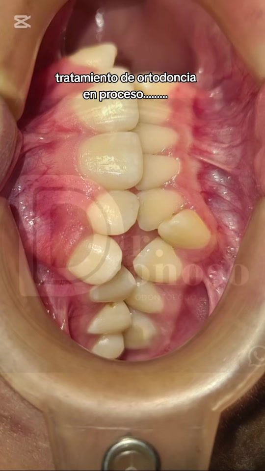 TikTok video thumbnail by dr.donoso
