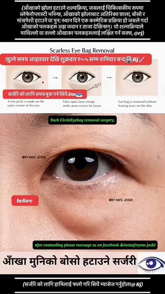 TikTok video thumbnail by ryans_joshi
