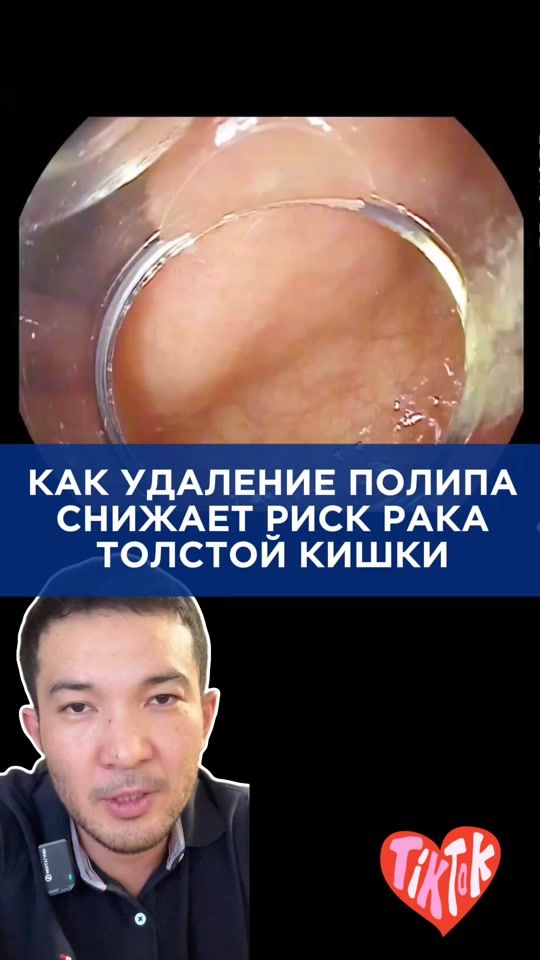 TikTok video thumbnail by almaty_endoscopy
