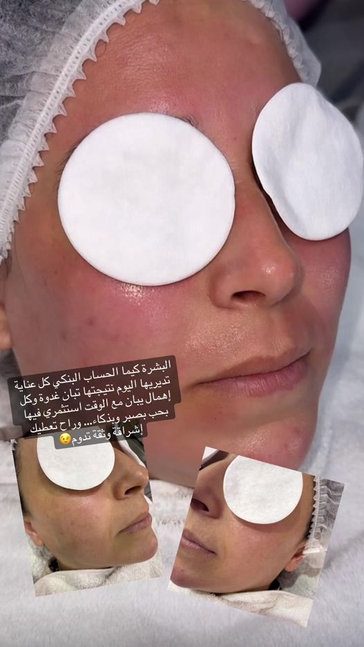 TikTok video thumbnail by randa_194