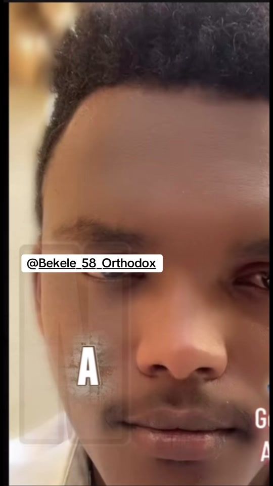 TikTok video thumbnail by gammeekoo16
