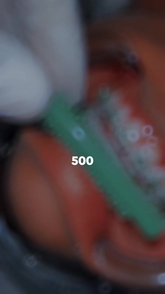 TikTok video thumbnail by flaquitohbrackets