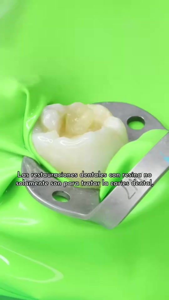 TikTok video thumbnail by perfect_dentika