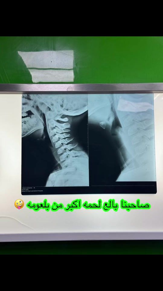 TikTok video thumbnail by sara.moamer