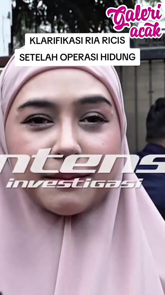 TikTok video thumbnail by galeri.acak