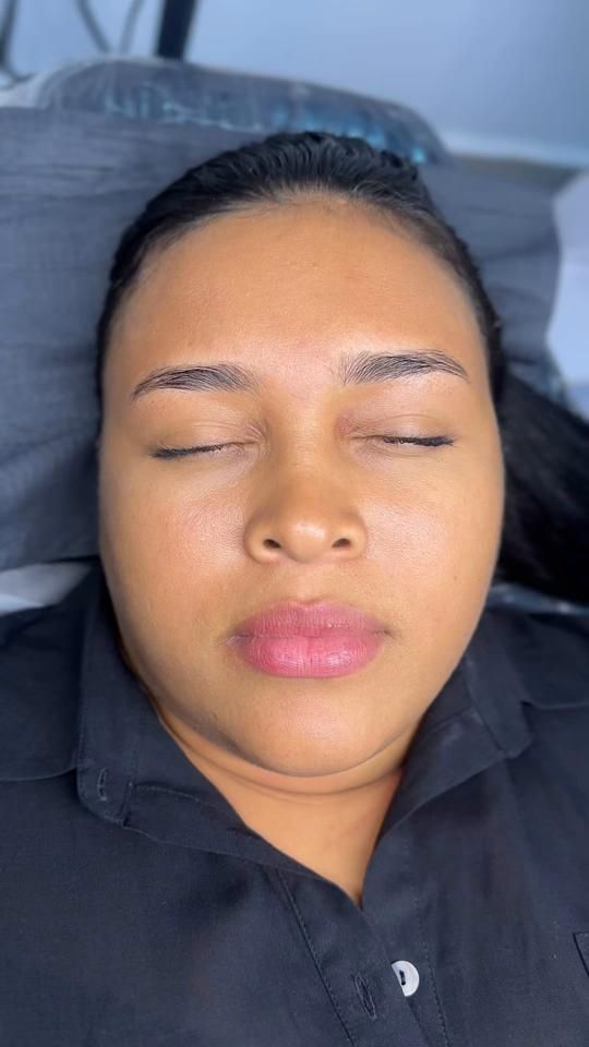 TikTok video thumbnail by clinicacejasrous