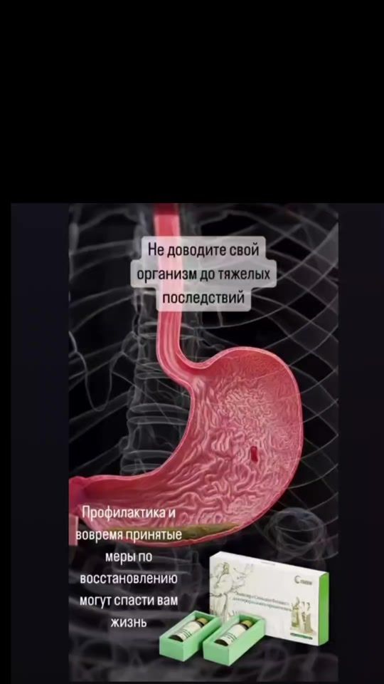 TikTok video thumbnail by elnurrasulzade