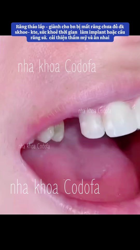 TikTok video thumbnail by nhakhoa_codofa