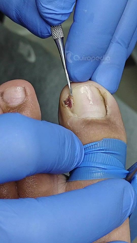 TikTok video thumbnail by quiropediacenter