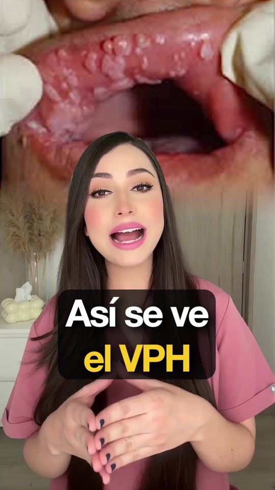 TikTok video thumbnail by pauzunigaoficial