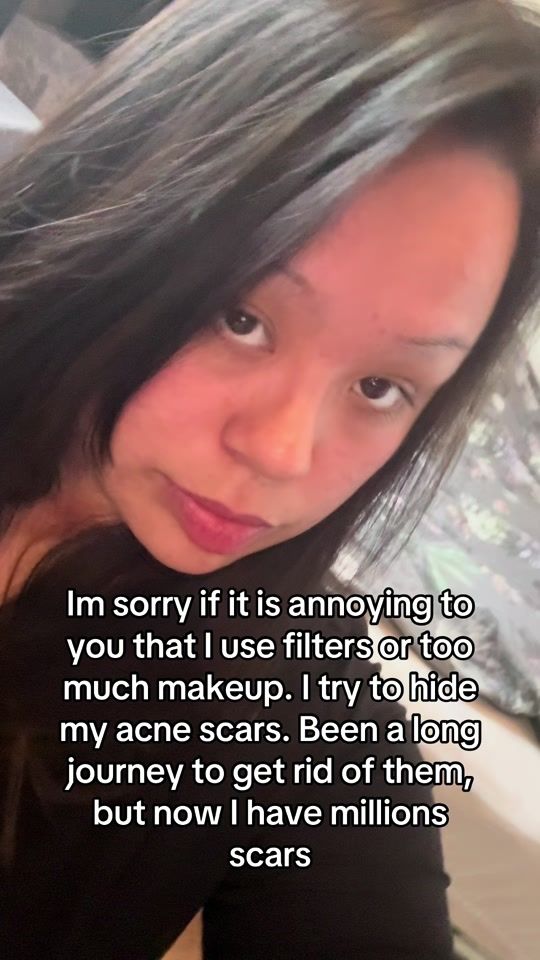 TikTok video thumbnail by dianiko3