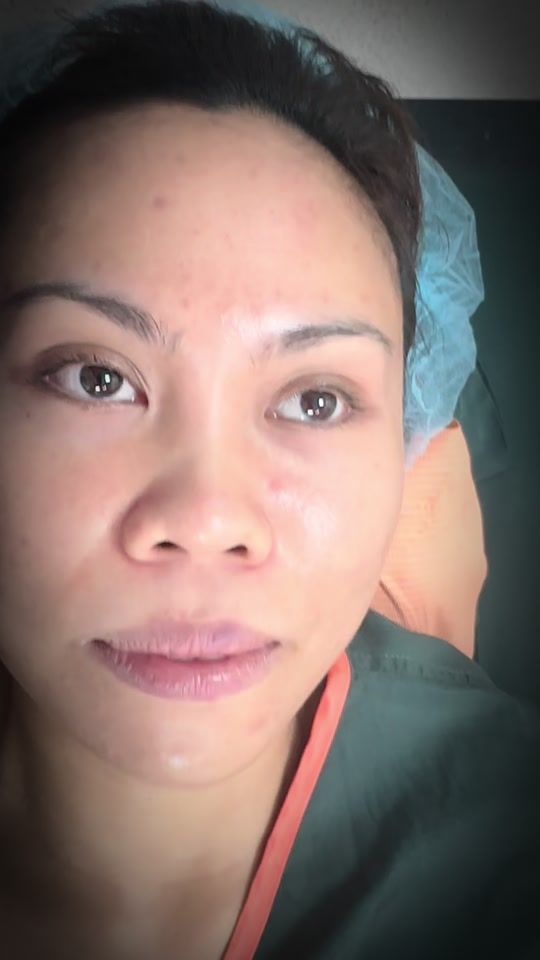 TikTok video thumbnail by lajo_md