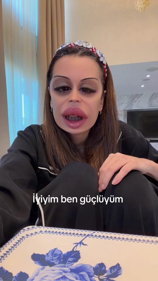 TikTok video thumbnail by dilanpolat